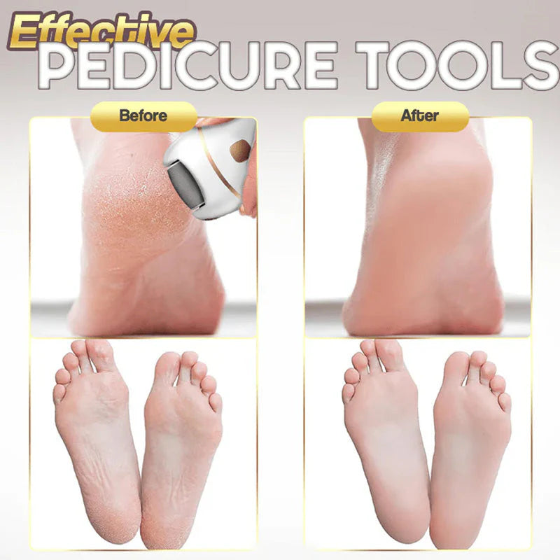 Rechargeable Electric Foot Exfoliating Scrubber