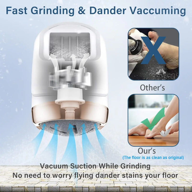 Pedicure Machine Callus Remover - Dead Skin Remover